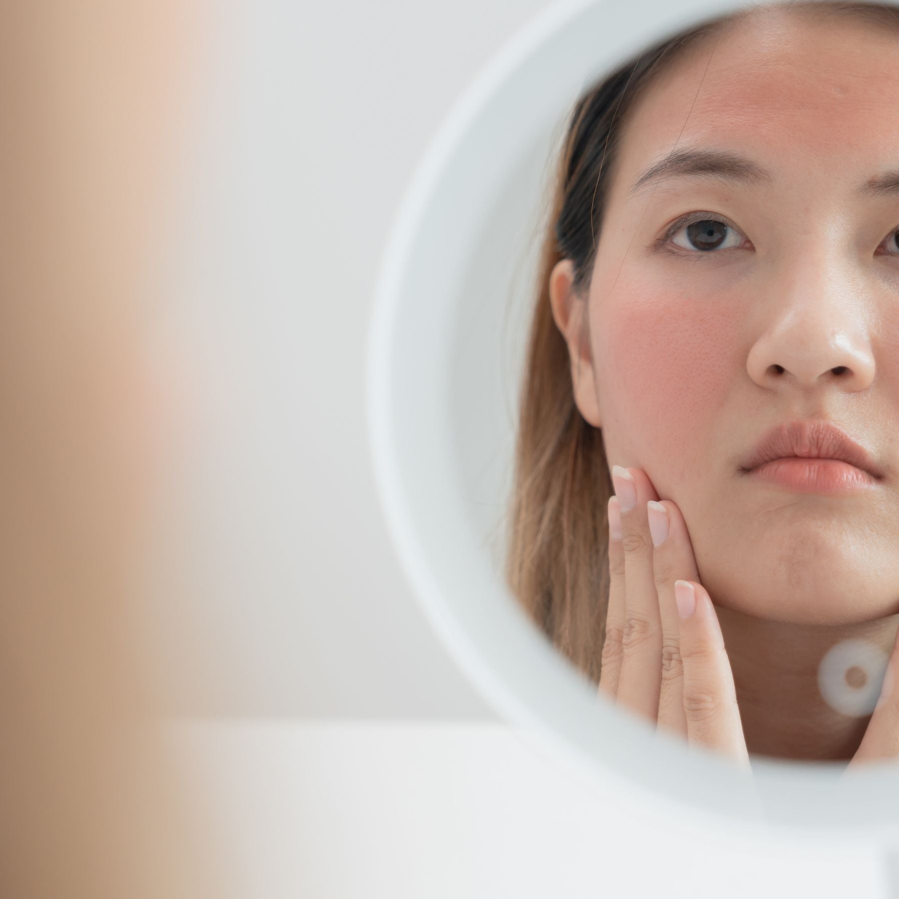 rogueurs visage rosacee rougeurs emotionnelles