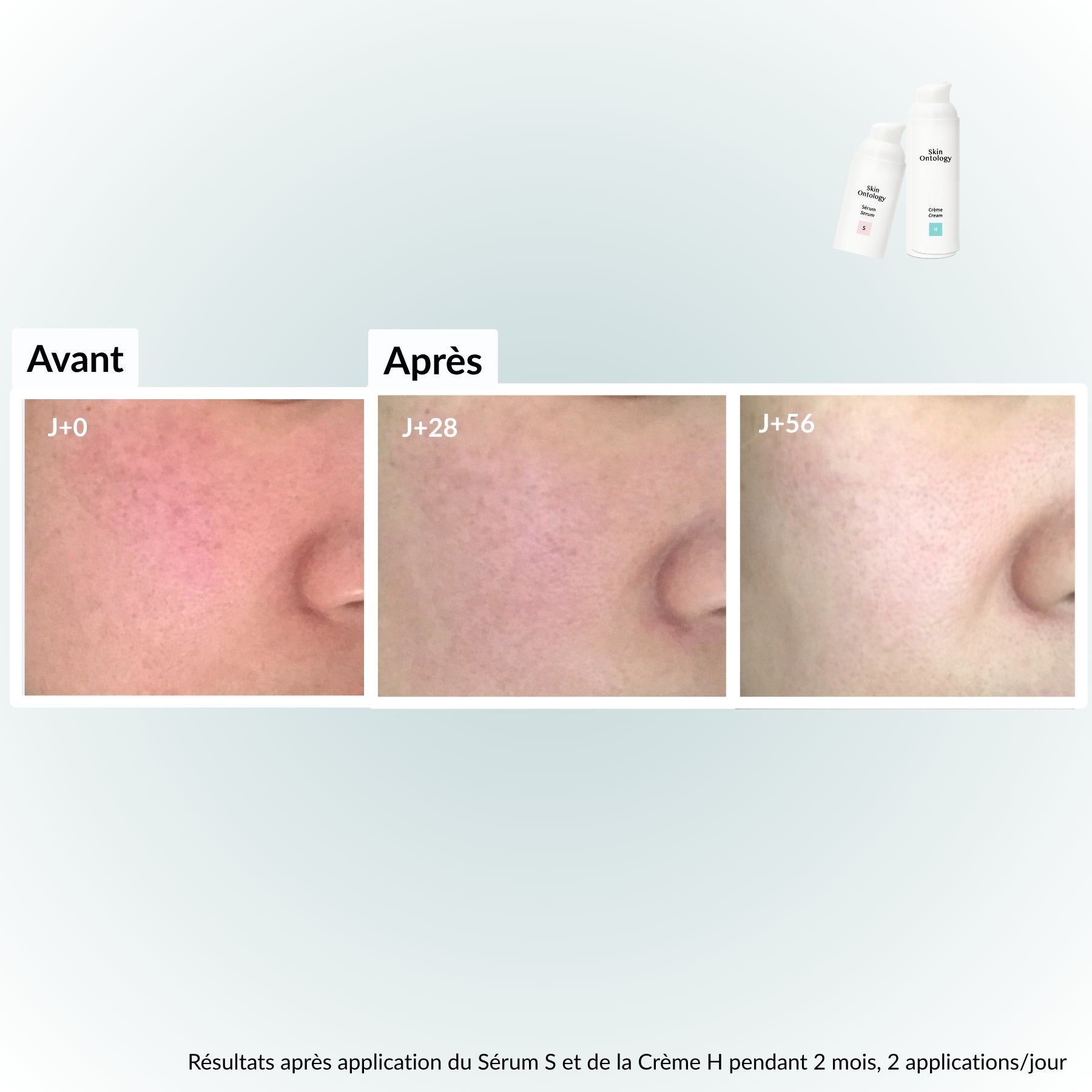 Crème H : Hydratante, Réparatrice & Raffermissante